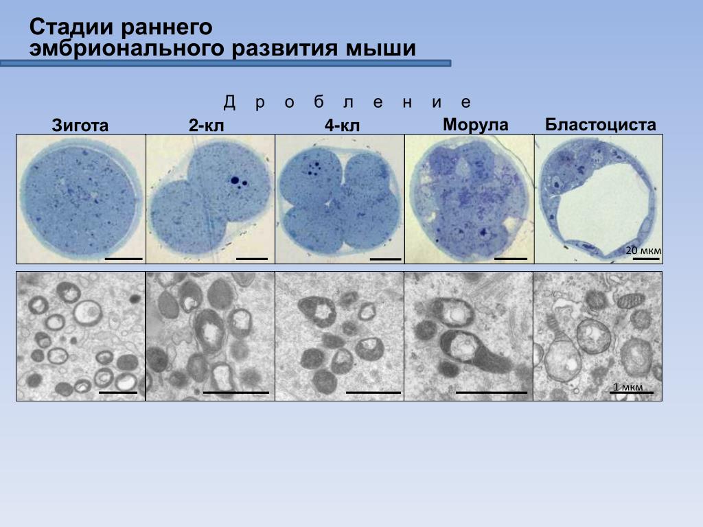 Простейшие этапы развития. Морула стадия раннего эмбрионального. Стадии развития эмбриона бластоциста. Бластоциста на 5 день. Стадии развития эмбриона морула.