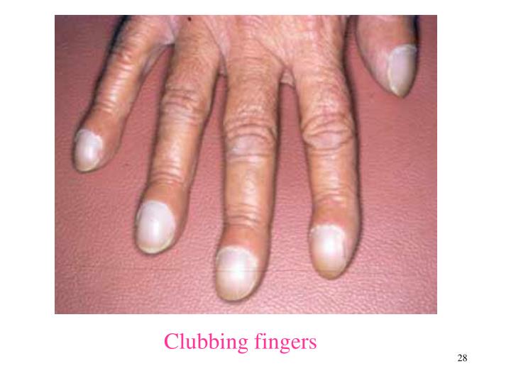 PPT Respiratory Symptoms PowerPoint Presentation ID5650763