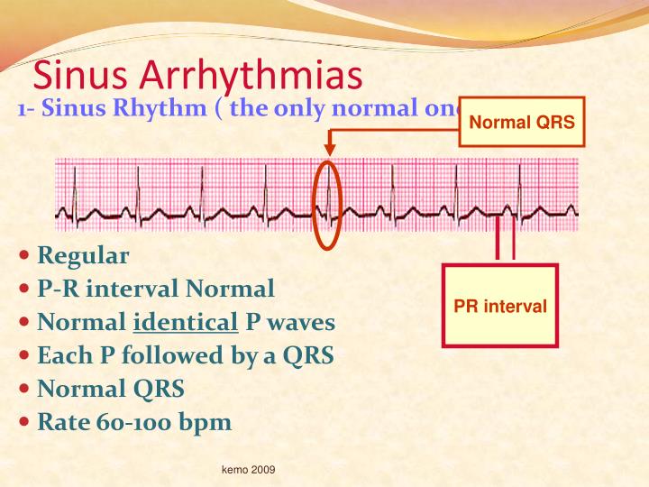 PPT - Basic Dysrhythmia &Recording ECG PowerPoint Presentation - ID:5651963