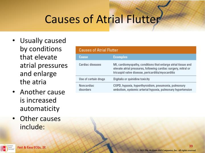 atrial flutter causes definition