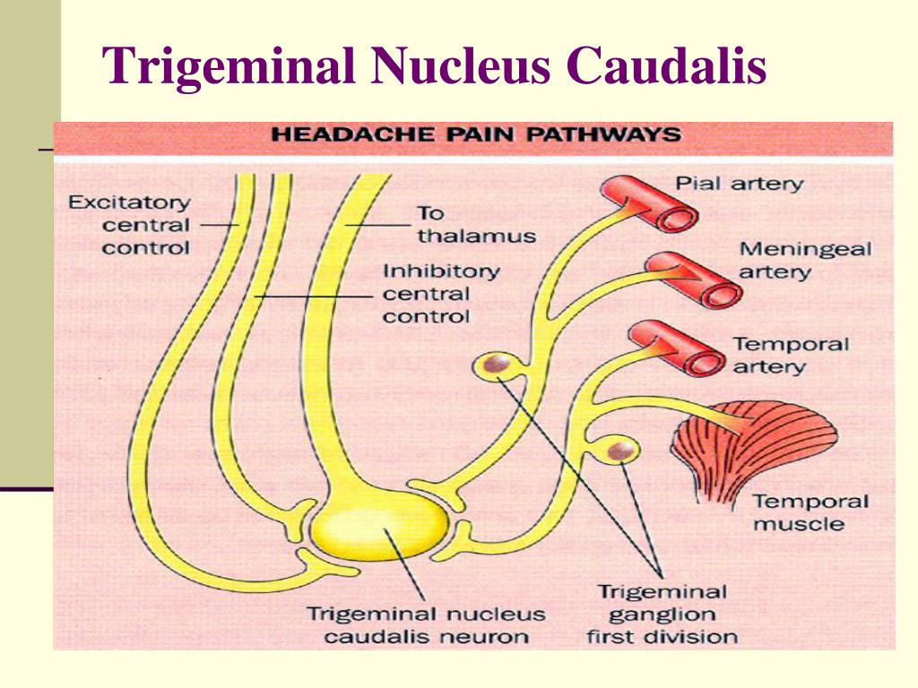 PPT Cephalalgia PowerPoint Presentation Free Download ID 5660313 PPT Cephalalgia PowerPoint Presentation Free Download ID 5660313