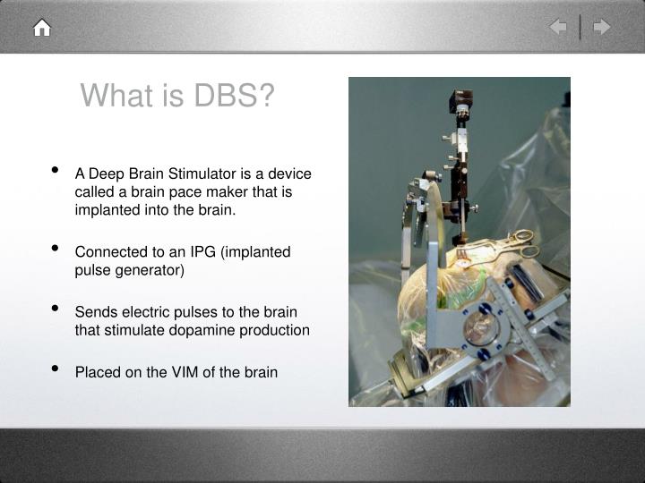 PPT - DBS on Parkinson’s Disease PowerPoint Presentation - ID:5664169