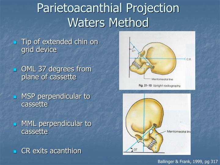 PPT Radiography of the Orbits PowerPoint Presentation ID5669687