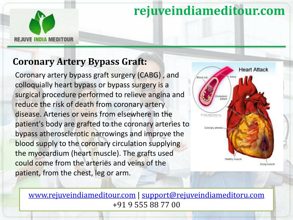 PPT - Heart surgery in India at affordable cost PowerPoint Presentation ...
