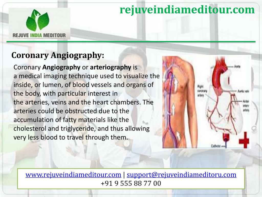 PPT - Heart surgery in India at affordable cost PowerPoint Presentation ...