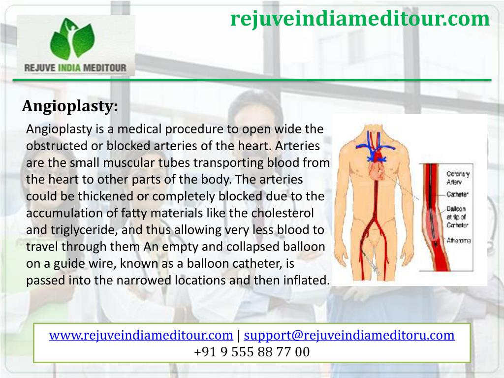 PPT - Heart surgery in India at affordable cost PowerPoint Presentation ...