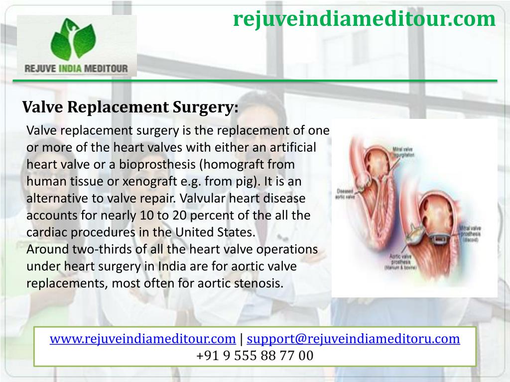 PPT - Heart surgery in India at affordable cost PowerPoint Presentation ...