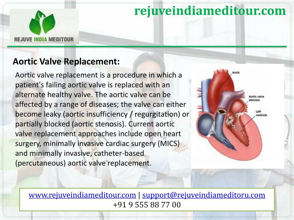 PPT - Heart surgery in India at affordable cost PowerPoint Presentation ...