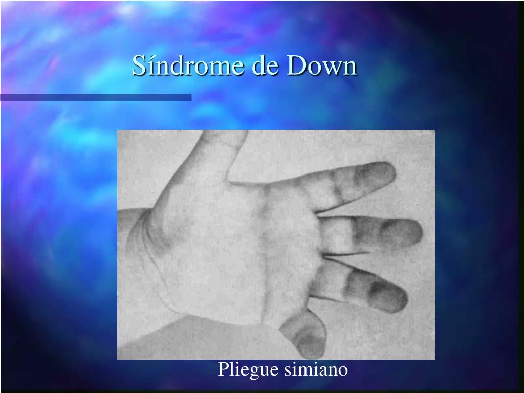 PPT Anormalidades Cromos micas PowerPoint Presentation Free Download 