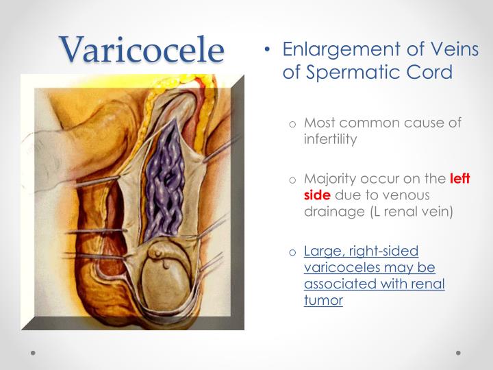 Ppt Scrotal Ultrasound Powerpoint Presentation Id 5671926