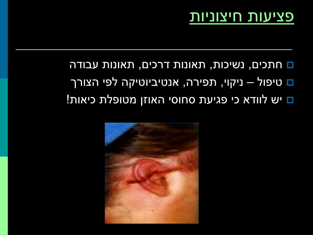 PPT - אוזן חיצונית External ear PowerPoint Presentation, free download -  ID:5673040