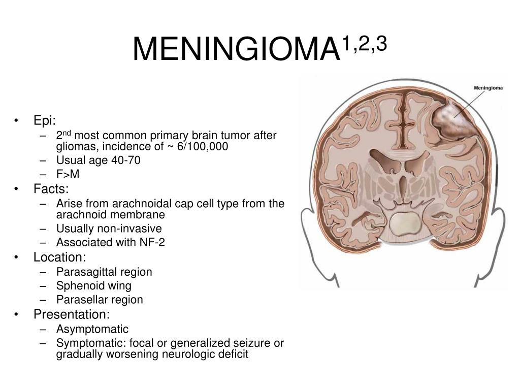 Объемное образование головного мозга мкб 10. Менингиома головного мозга. Менингиома головного мозга описание.
