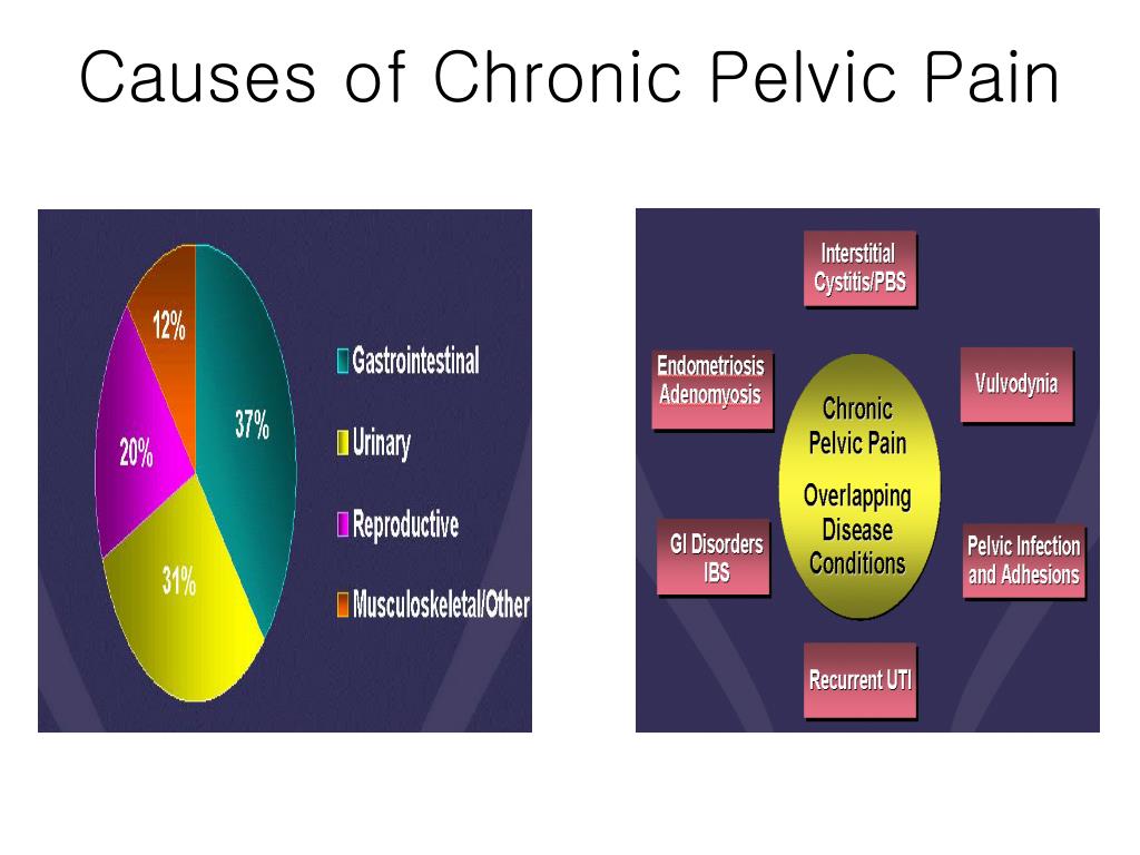 PPT - Chronic Pelvic Pain Pelvic Congestion Syndrome PowerPoint