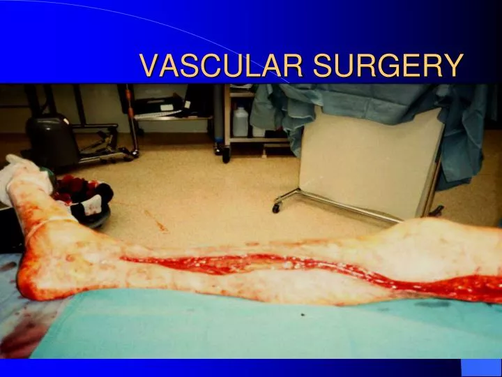 vascular surgery n.