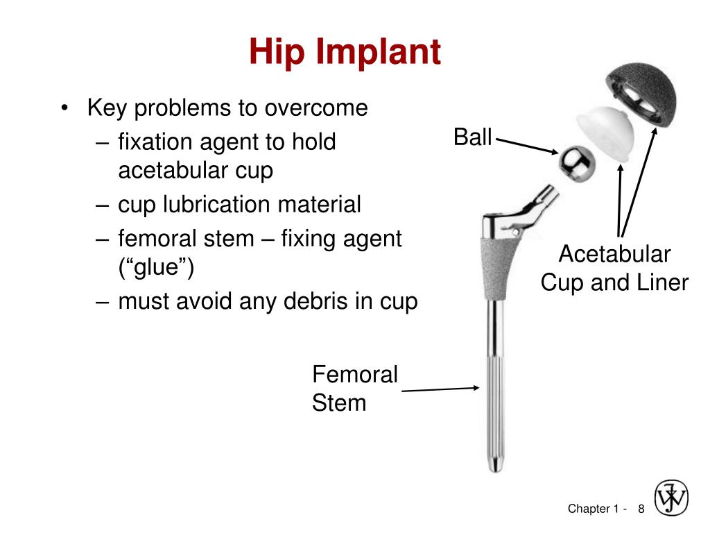 Key problems. Acetabular Liner. Acetabular Cemented Cup. Acetabular Cup x ray. Continuum revision Multiholes Hip acetabular Cup.