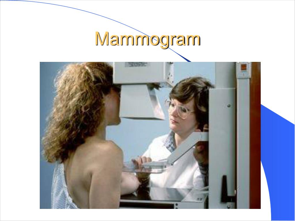 Маммографию после флюорографии. Аппарат для маммографии. Цифровая маммография. Маммография молочных желез. Методика проведения маммографии.