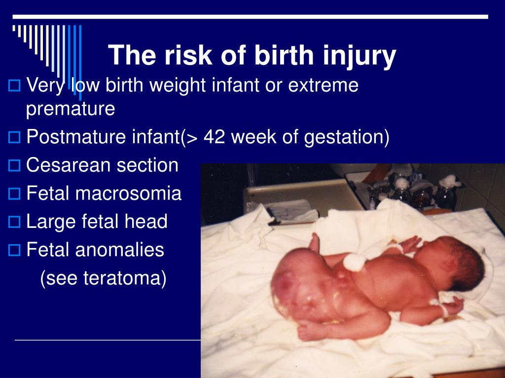 Ppt Asphyxia Of The Newborn Birth Trauma Powerpoint Presentation