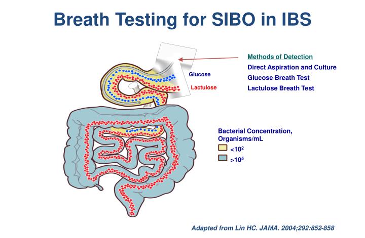 bacterial overgrowth breath test bacterial overgrowth breath test