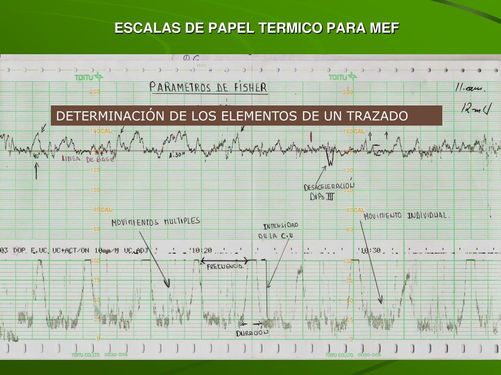 PPT - ESCALAS DE PAPEL PARA MONITOREO ELECTRONICO FETAL PowerPoint  Presentation - ID:5695294