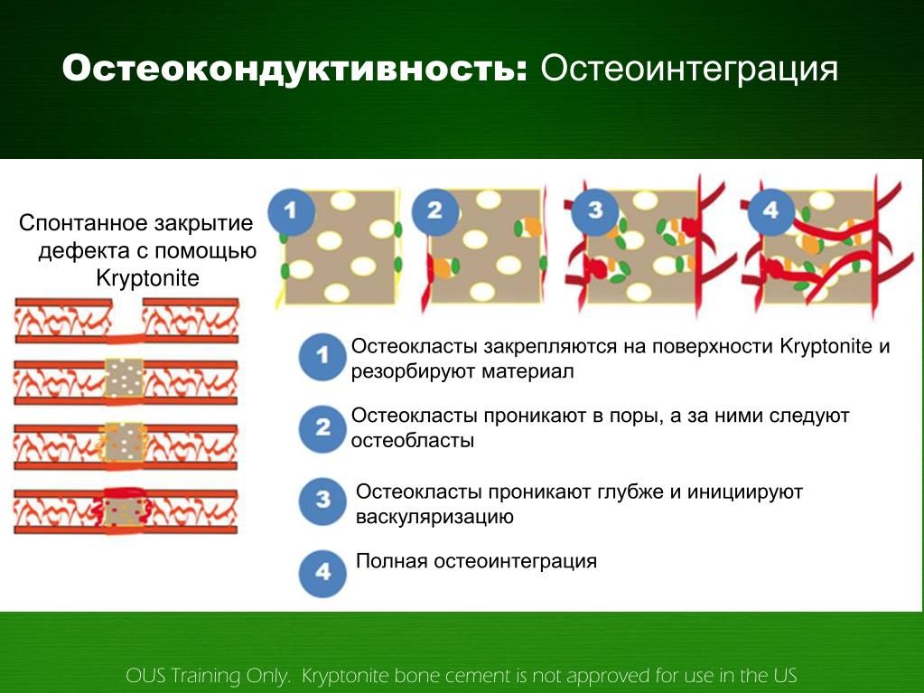 Феномен остеоинтеграции факторы влияющие на оптимизацию этого процесса презентация