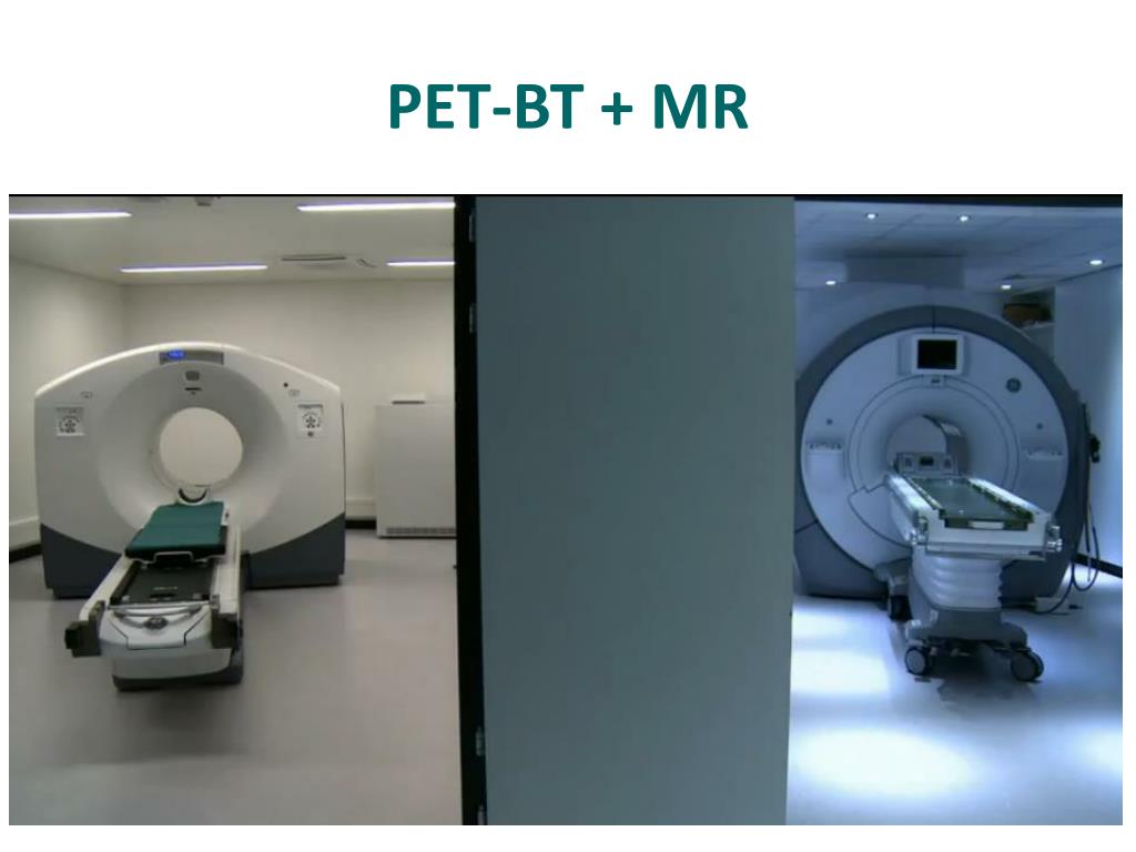 PPT - Diğer yöntemler: Bronkoskopik erken tanı, Diffüzyon MR, PET-MR ...