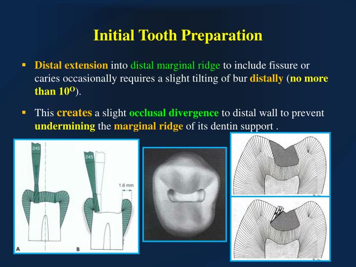 PPT - Class I & V Cavity preparation for Amalgam Restoration PowerPoint ...