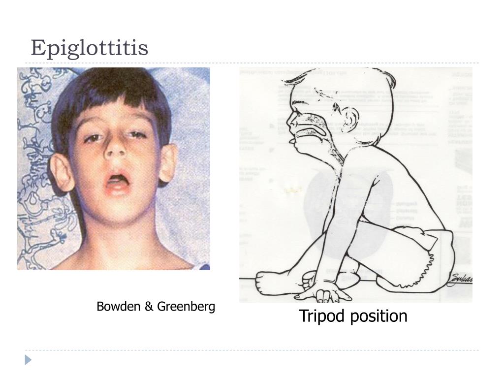 PPT Alteration in Respiratory Function PowerPoint Presentation, free PPT Alteration in Respiratory Function PowerPoint Presentation, free