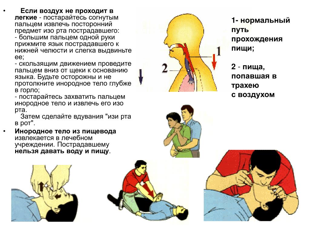 Повреждение верхних дыхательных путей. Оказание первой помощи при дыхательной недостаточности. Неотложная помощь при обструкции дыхательных путей инородным телом. Оказание первой помощи при острой дыхательной недостаточности. Первая врачебная помощь при острой дыхательной недостаточности.