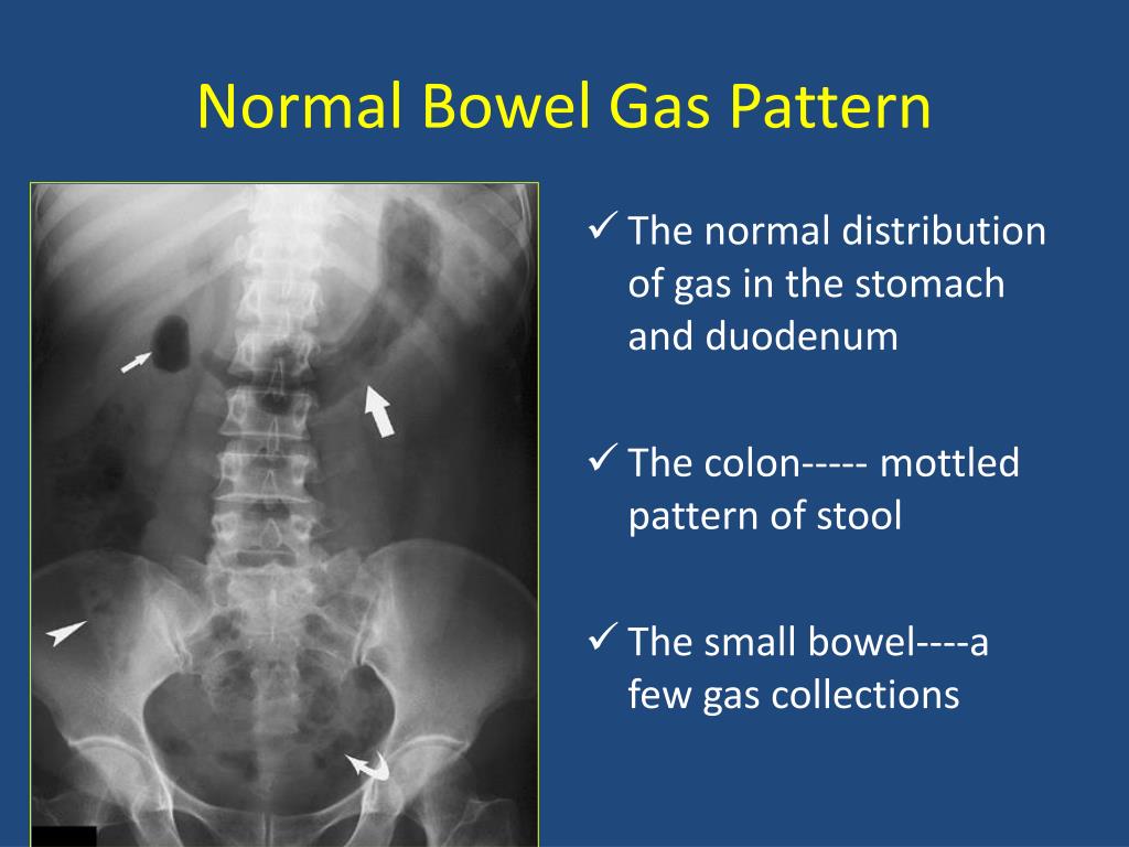 PPT  Radiology of Digestive System PowerPoint Presentation free download  ID 5714120