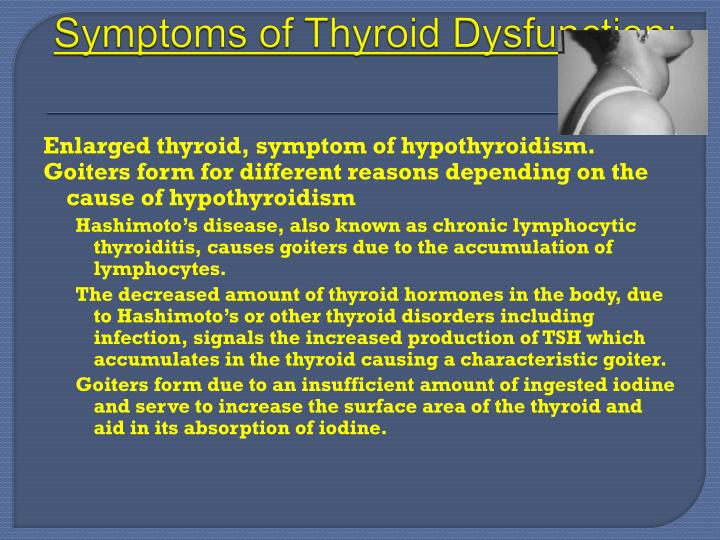 what causes a goiter on your thyroid what causes a goiter on your thyroid
