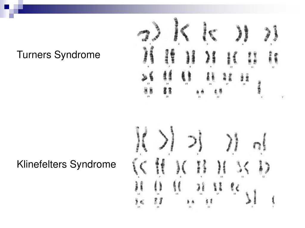 Ppt Chromosomes And Human Genetics Powerpoint