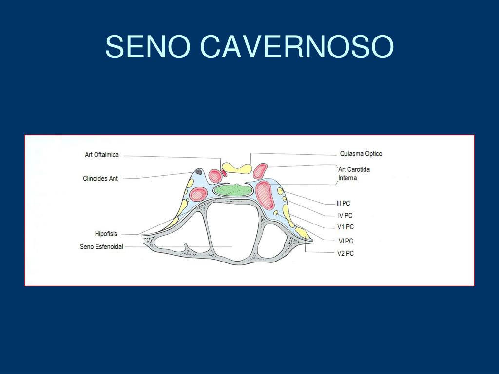 PPT INTRODUCCION PowerPoint Presentation Free Download ID 5718528