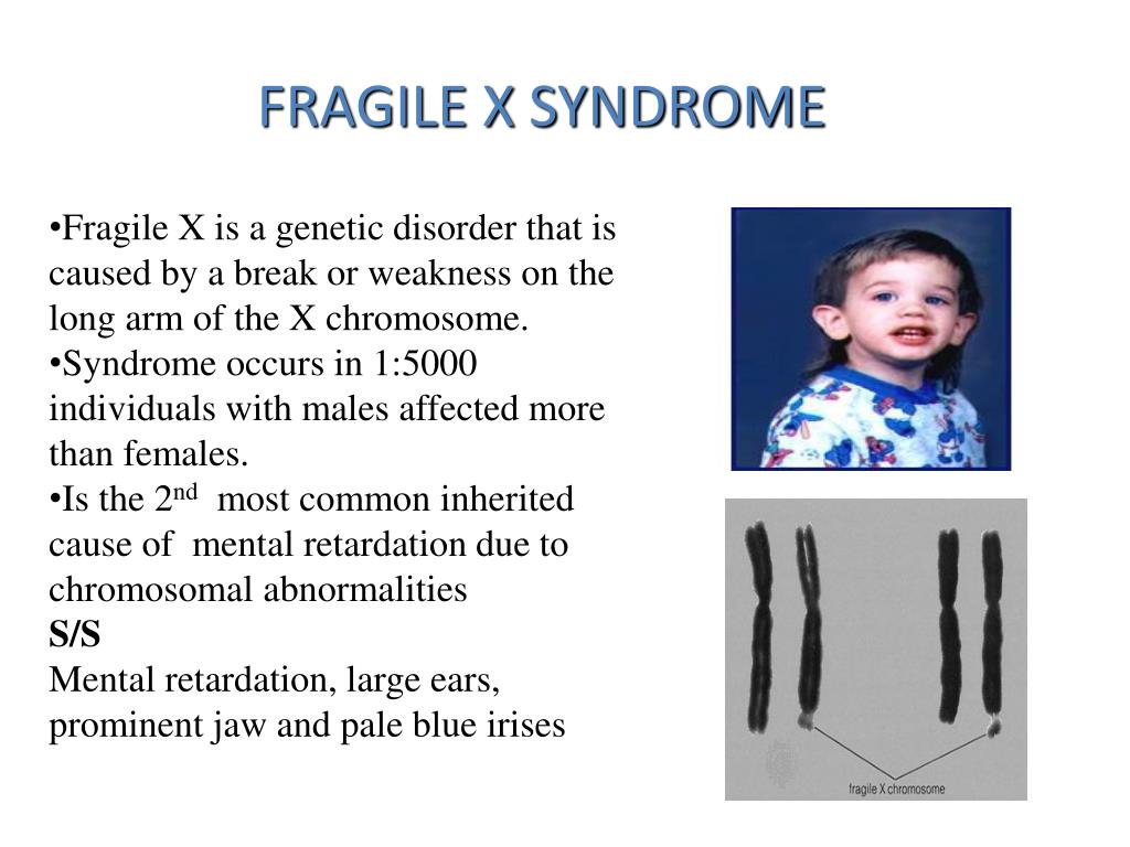 Ppt Chromosomal Abnormalities Powerpoint Presentation Free Download Id 5719987