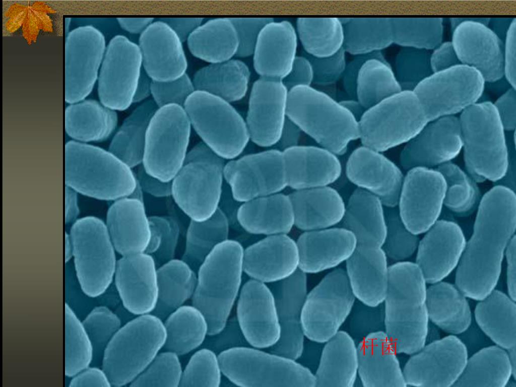 Бордетелла. Бактерия Bordetella pertussis. Коклюш бордетелла пертуссис. Возбудитель коклюша Bordetella pertussis. Bordetella parapertussis бактерии.