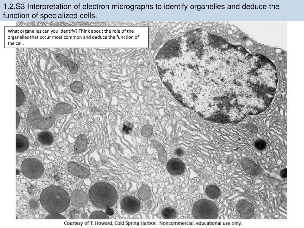 Митохондрии в клетках печени. Лизосома микрофотография. Лизосомы в электронном микроскопе. Лизосомы под электронным микроскопом. Лизосома электронная микрофотография.