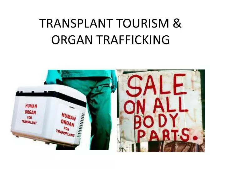 transplant tourism organs