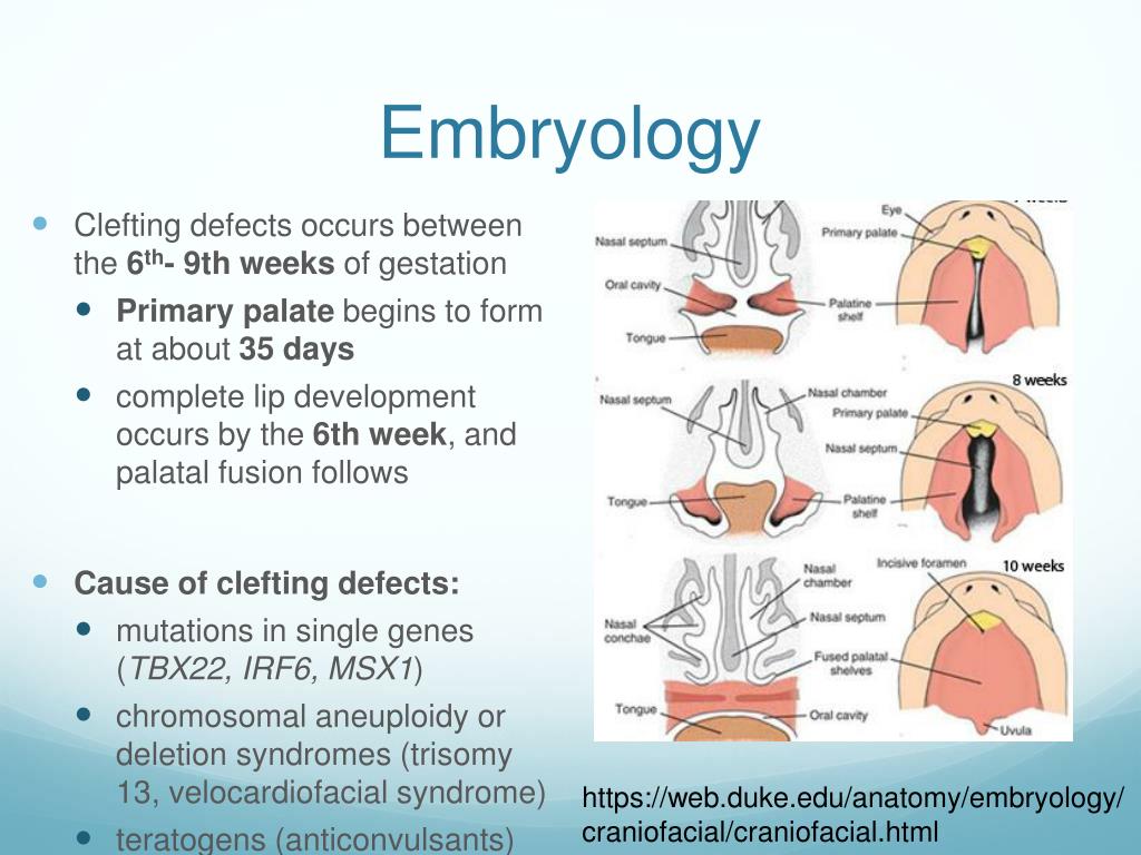 PPT Cleft Anomalies PowerPoint Presentation Free Download ID 5729628