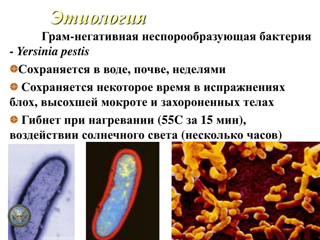 Три организма относящиеся к бактериям