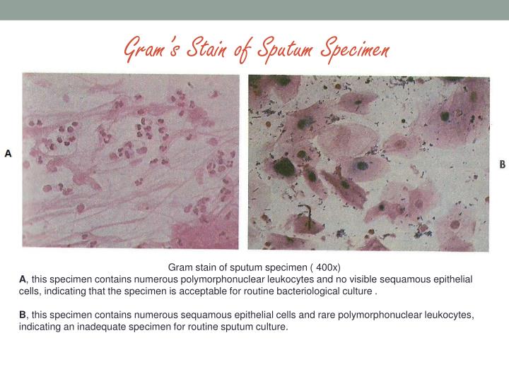 PPT SPUTUM culture PowerPoint Presentation ID5731153