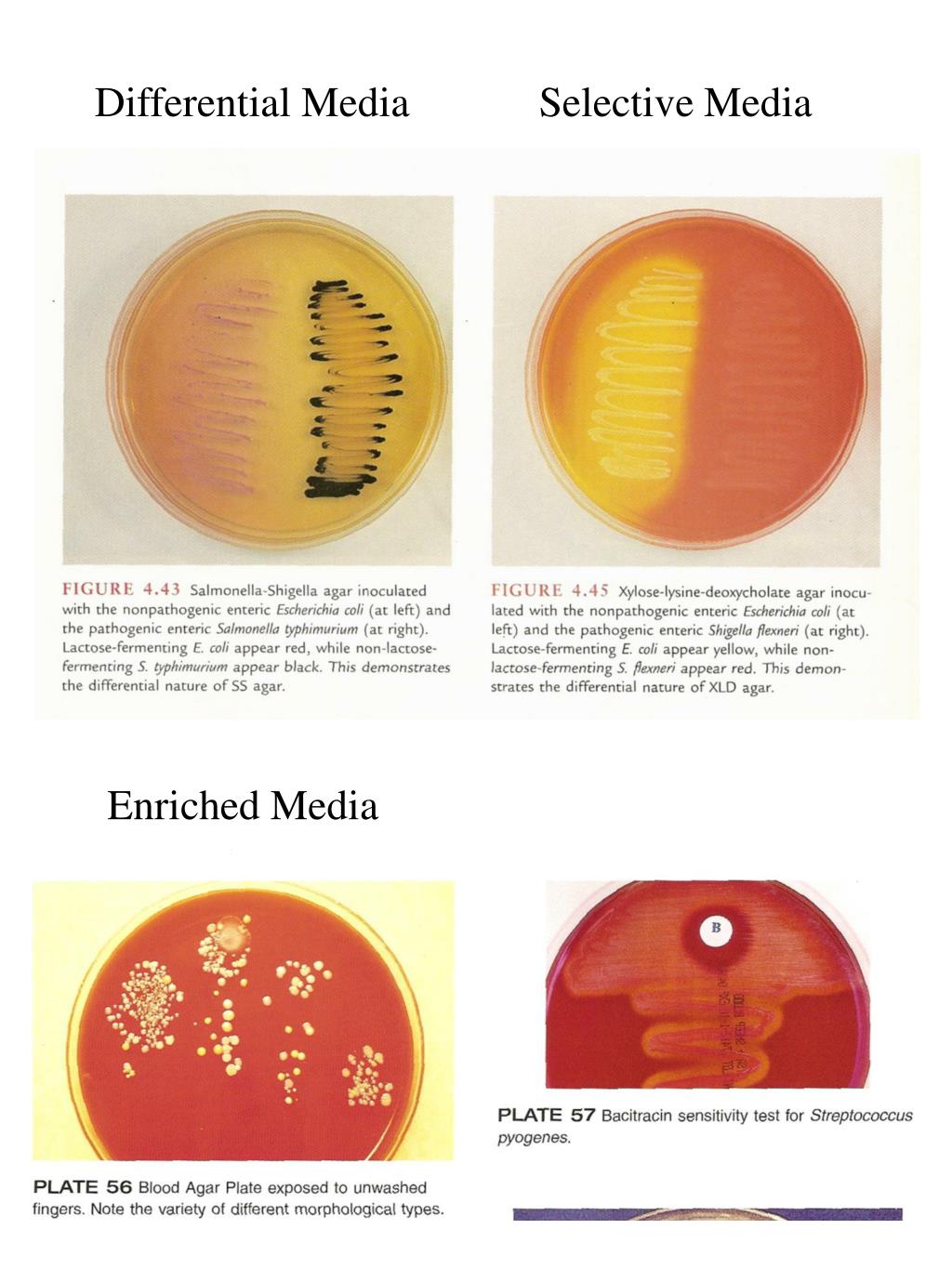 4 blood agar and hemolysis and mac-conkey.ppt