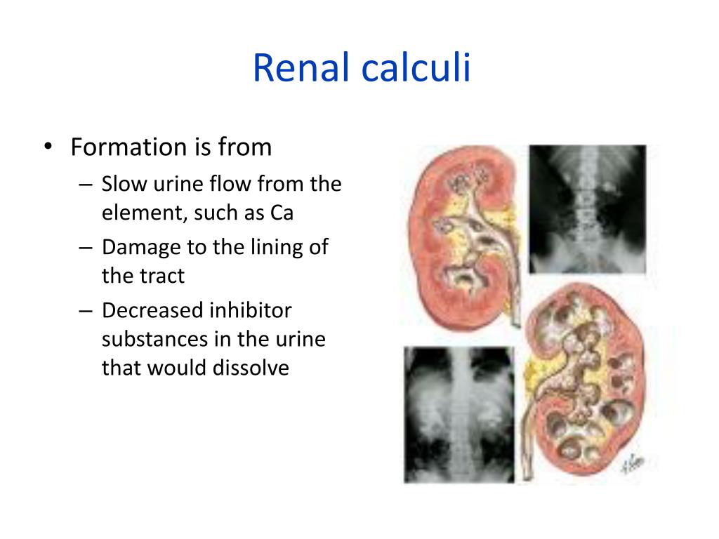 ppt-management-of-patients-with-alterations-in-the-renal-system-powerpoint-presentation-id