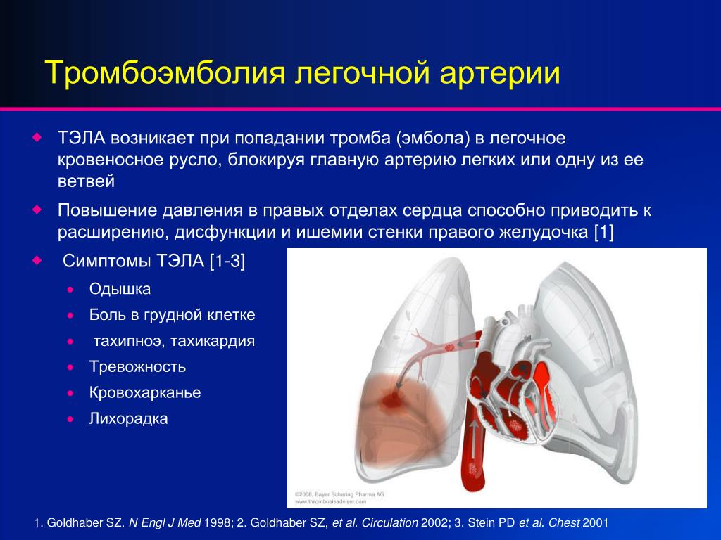 Тромбоэмболия симптомы. Эмболия легочной артерии симптомы. Патогенез тромбоэмболия ветвей легочной артерии. Тромбоэмболия легочной артерии клиника. Тромбоз лёгочной артерии симптомы.