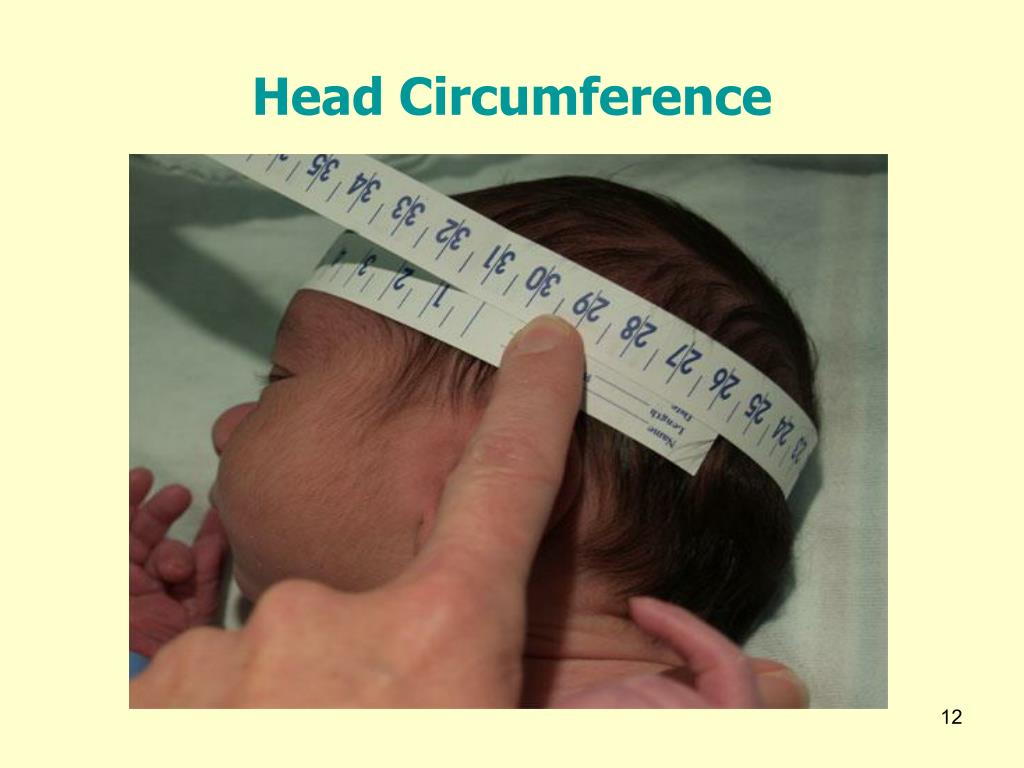 Маленькая окружность головы. Микроцефалия окружность головы. Измерение окружности головы у детей. Измерение окружности головы грудного ребенка. Измерение роста ребенка.