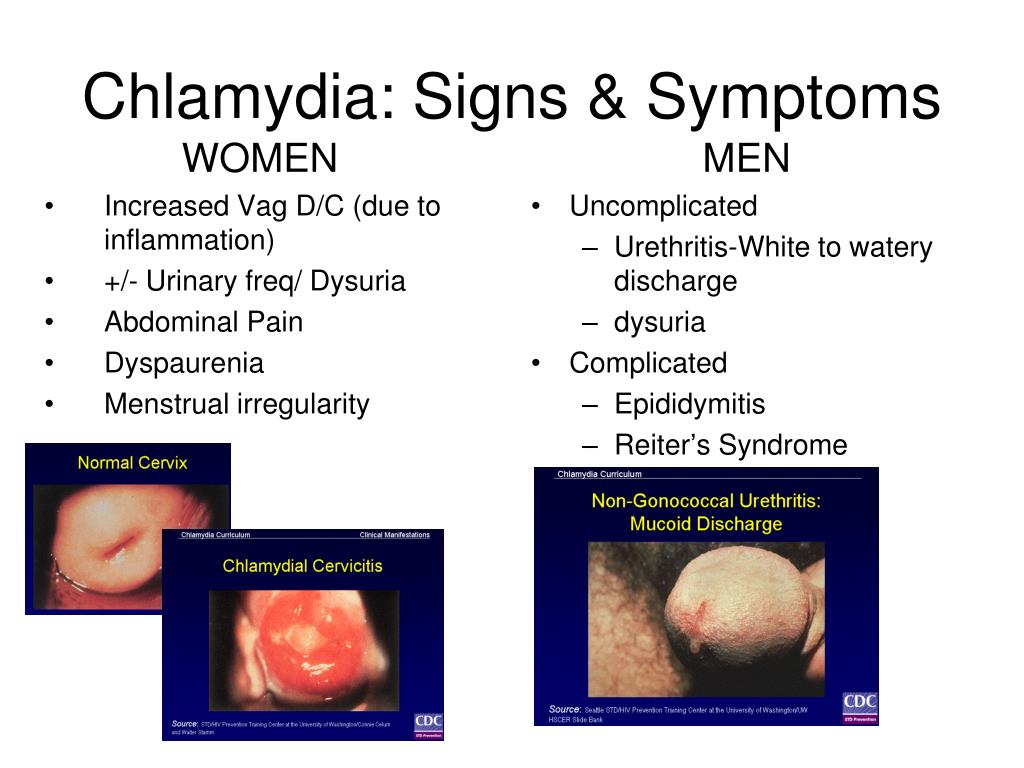 Pdf Anatomical Site Prevalence And Genotypes Of Chlamydia Trachomatis Infections Among Men Who Have Sex With Men