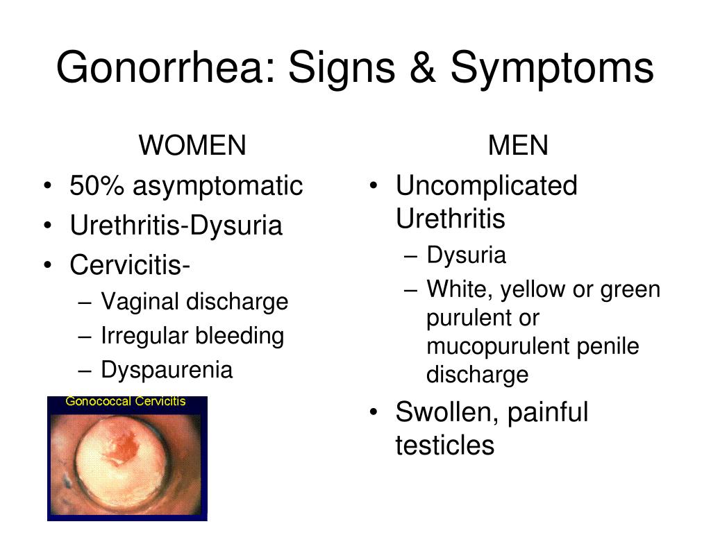 men gonorrhea symptoms