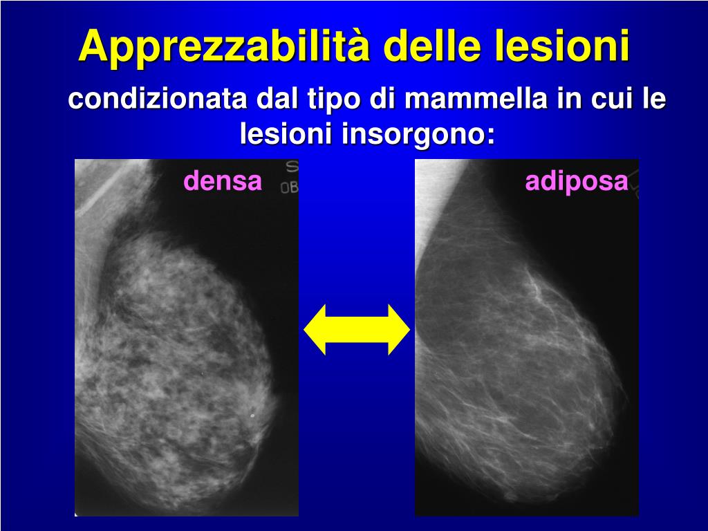 Linee Guida Lesioni B3 Mammella PPT - DIAGNOSTICA PER IMMAGINI DELLA MAMMELLA PowerPoint Presentation