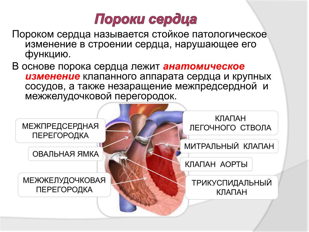 Порог сердца что это. Заболевания сердца приобретенный порок. Врожденные и приобретенные пороки сердца. Наиболее распространенные пороки сердца. Патологии сердца врожденные и приобретенные пороки.