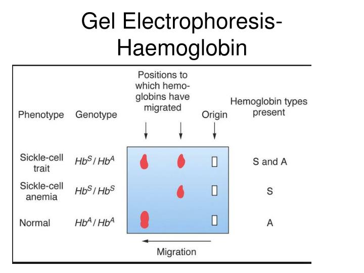 sickle cell gel electrophoresis