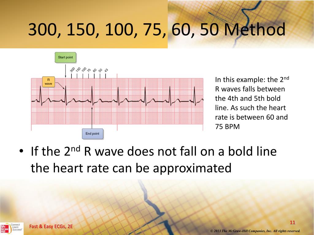 Ppt Heart Rate Powerpoint Presentation Free Download Id