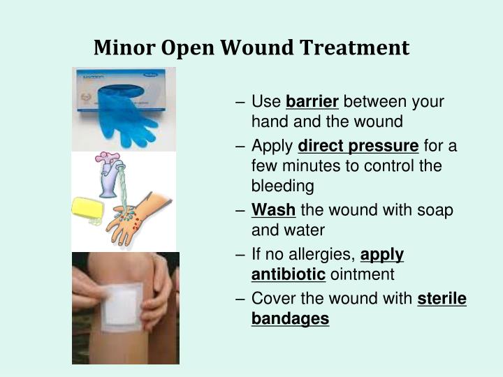 PPT First Aid PowerPoint Presentation ID5767765